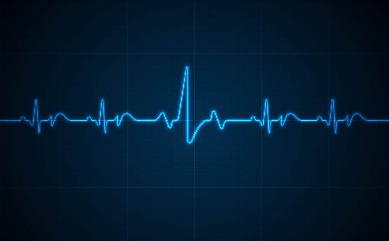 Heart Rhythm